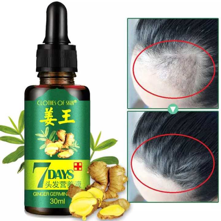 7 Day Ginger Oil Natural Hair Loss Treatement